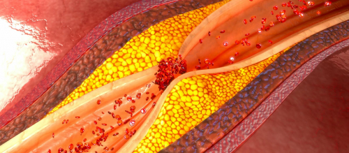 ECNi - Conférence Cardiologie - Rythmologie